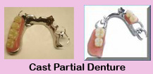 Affordable dental plans,Affordable dental plans India