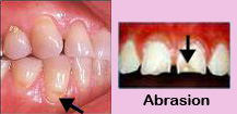 Affordable dental plans,Affordable dental plans India