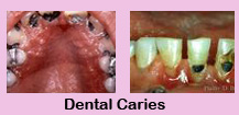 Affordable dental plans,Affordable dental plans India