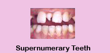 Cheap Dental Treatment,Cheap Dental Treatment India