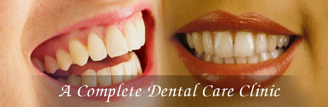 welcome in smile care tooth filling