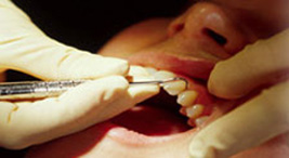 Discount dental plans,Discount dental plans India